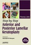 STEP BY STEP ANTERIOR AND POSTERIOR LAMELLAR KERATOPLASTY(WITH DVD)