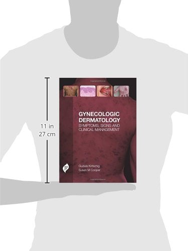 GYNECOLOGIC DERMATOLOGY SYMPTOMS, SIGNS AND CLINICAL MANAGEMENT