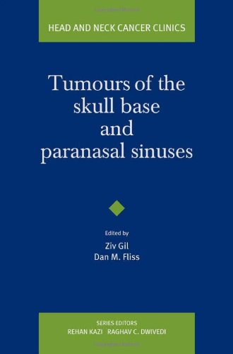 Tumours of the Skull Base and Paranasal Sinuses (Head and Neck Cancer Clinics) - Retail Maharaj