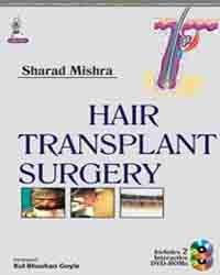 HAIR TRANSPLANT SURGERY