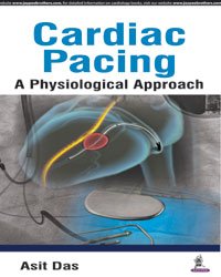 CARDIAC PACING A PHYSIOLOGICAL APPROACH