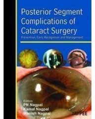 Posterior(R) Segment Complications Of Cataract Surgery Prev. ,Early Recog. And Management