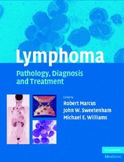 Lymphoma: Pathology,Diagnosis and Treatment