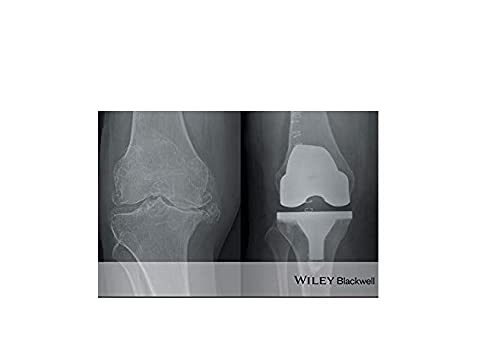 ABC of Orthopaedics and Trauma: 257 (ABC Series)