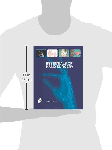 Essentials of Hand Surgery