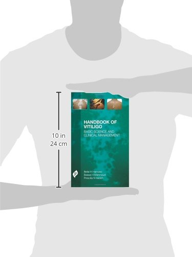 Handbook of Vitiligo