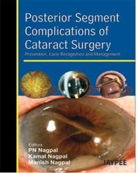 POSTERIOR SEGMENT COMPLICATIONS OF CATARACT SURGERY PREV.,EARLY RECOG.AND MANAGEMENT