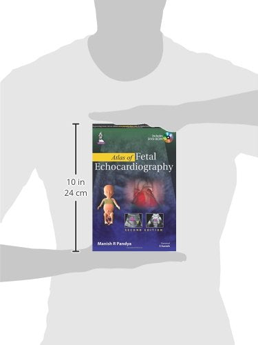 Atlas of Fetal Echocardiography with Interactive DVD-ROM