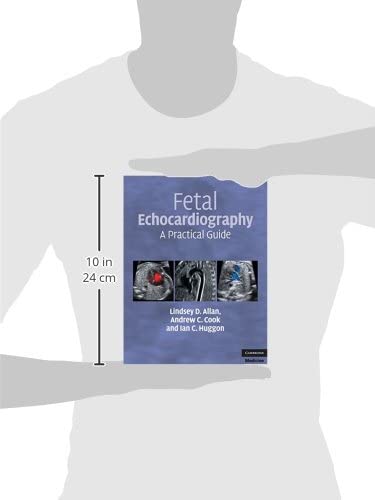 Fetal Echocardiography: A Practical Guide