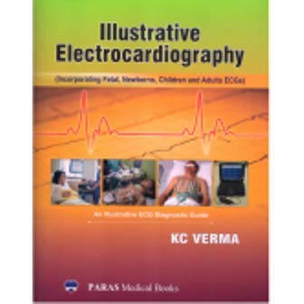 Illustrative Electrocardiography