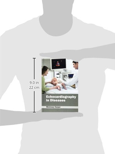 ECHOCARDIOGRAPHY IN DISEASES - Retail Maharaj