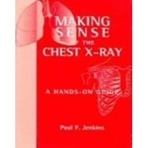 (OLD)MAKING SENSE OF THE CHEST X-RAY A HANDS-ON GUIDE