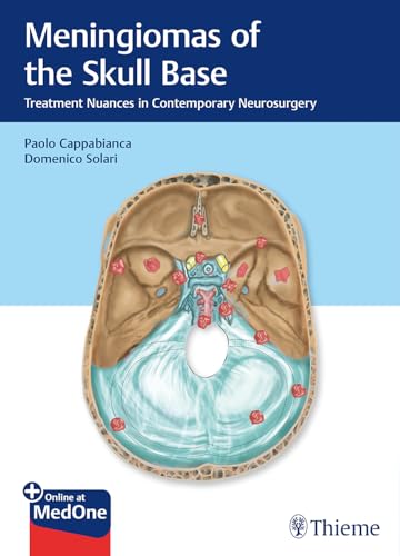 MENINGIOMAS OF THE SKULL BASE TREATMENT NUANCES IN CONTEMPORARY NEUROSURGERY WITH ACCESS CODE (HB 2019) - Retail Maharaj