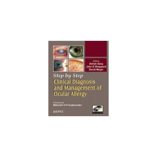 Step By Step Clinical Diagnosis And Management To Ocular Allergy With Photo Cd-rom