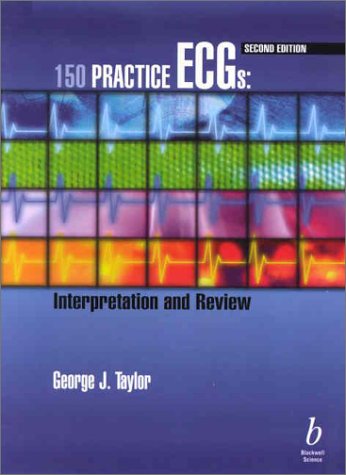 (EX)150 PRACTICE ECGS INTERPRETATION AND REVIEW