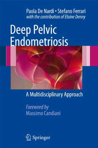 Deep Pelvic Endometriosis: A Multidisciplinary Approach - Retail Maharaj
