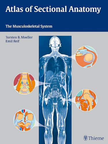 Atlas of Sectional Anatomy: The Musculoskeletal System - Retail Maharaj