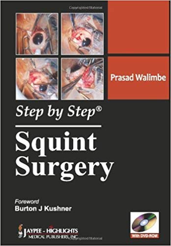 STEP BY STEP SQUINT SURGERY