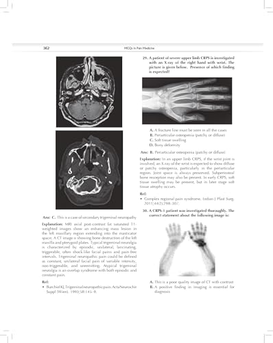 MCQs in Pain Medicine, 2/e | Over 2100 MCQs (PB 2026)
