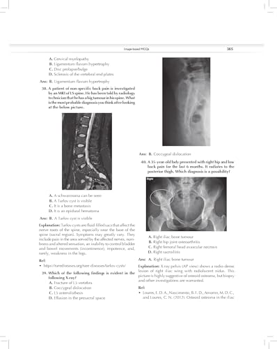 MCQs in Pain Medicine, 2/e | Over 2100 MCQs (PB 2026)