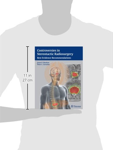 Sellar and Parasellar Tumors: Diagnosis, Treatments and Outcomes - Retail Maharaj