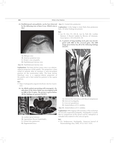 MCQs in Pain Medicine, 2/e | Over 2100 MCQs (PB 2026)