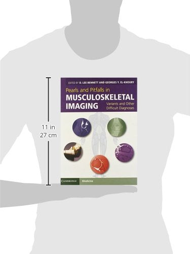 Pearls and Pitfalls in Musculoskeletal Imaging: Variants and Other Difficult Diagnoses