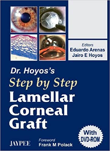 DR.HOYOS' STEP BY STEP LAMELLAR CORNEAL GRAFT WITH DVD-ROM