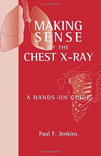 (OLD)MAKING SENSE OF THE CHEST X-RAY : A HANDS-ON GUIDE(ORG)