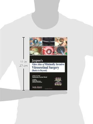 Jaypee Video Atlas Of Minimally Invasive Vitreoretinal Surgery