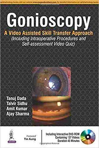 GONIOSCOPY:A VIDEO ASSISTED SKILL TRANSFER APPROACH WITH DVD-ROM