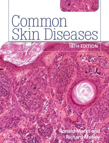 ROXBURGH'S COMMON SKIN DISEASES(IE)