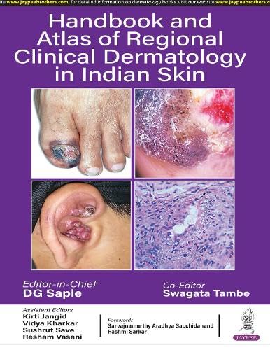 HANDBOOK AND ATLAS OF REGIONAL CLINICAL DERMATOLOGY IN INDIAN SKIN