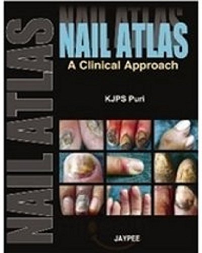Nail Atlas: A Clinical Approach