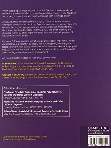 Pearls and Pitfalls in Musculoskeletal Imaging: Variants and Other Difficult Diagnoses
