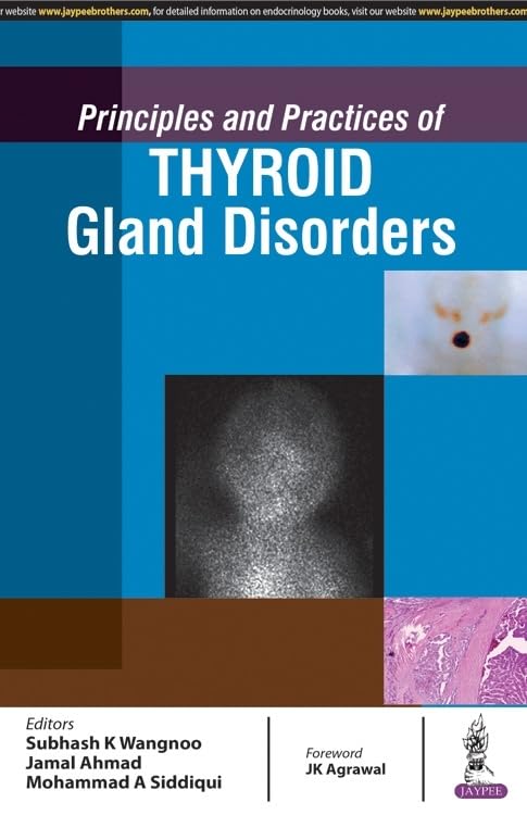 PRINCIPLES AND PRACTICES OF THYROID GLAND DISORDERS