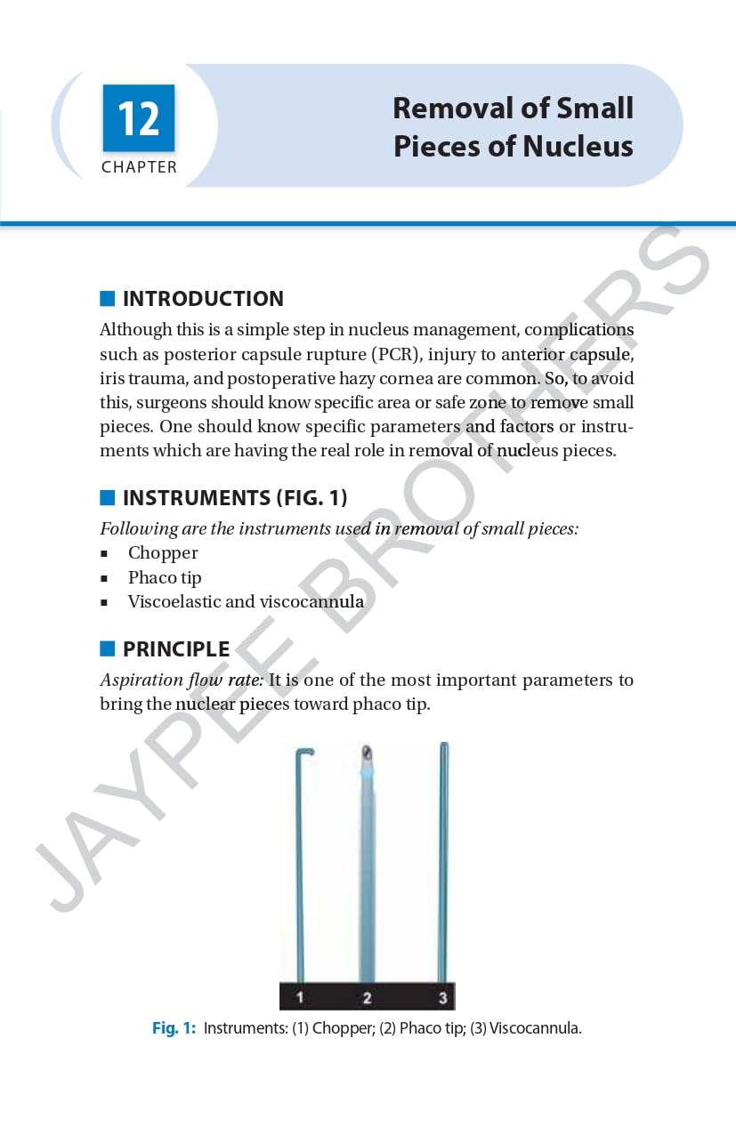 SIMPLIFIED PHACOEMULSIFICATION