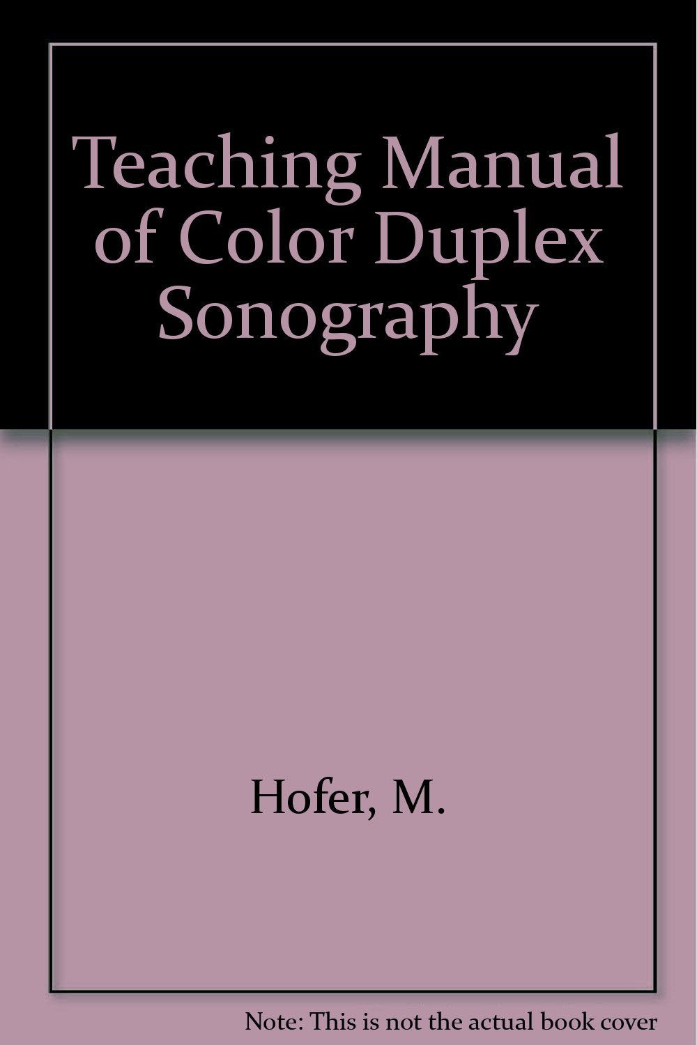 (EX)(OLD)TEACHING MANUAL OF COLOR DUPLEX SONOGRAPHY