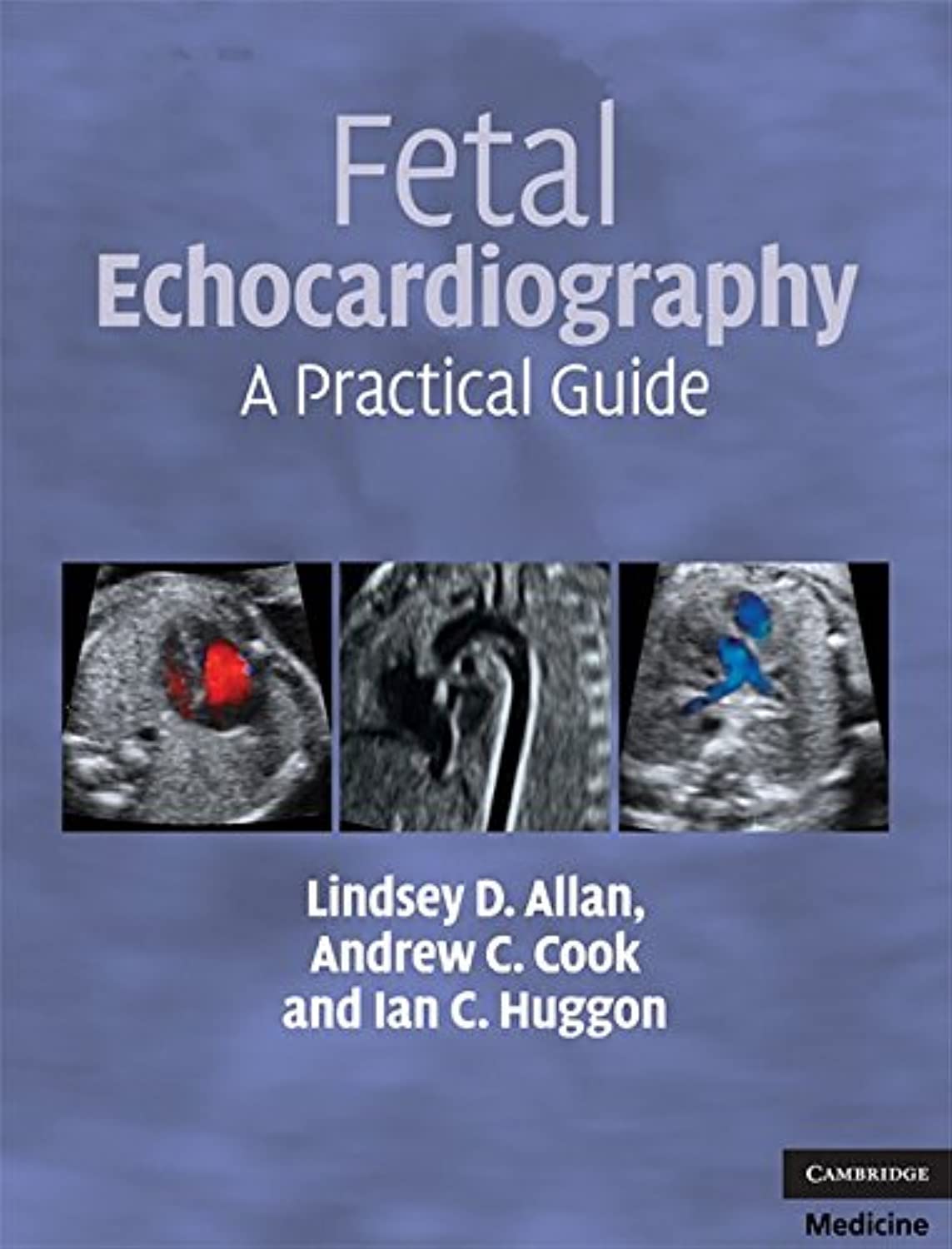 Fetal Echocardiography: A Practical Guide