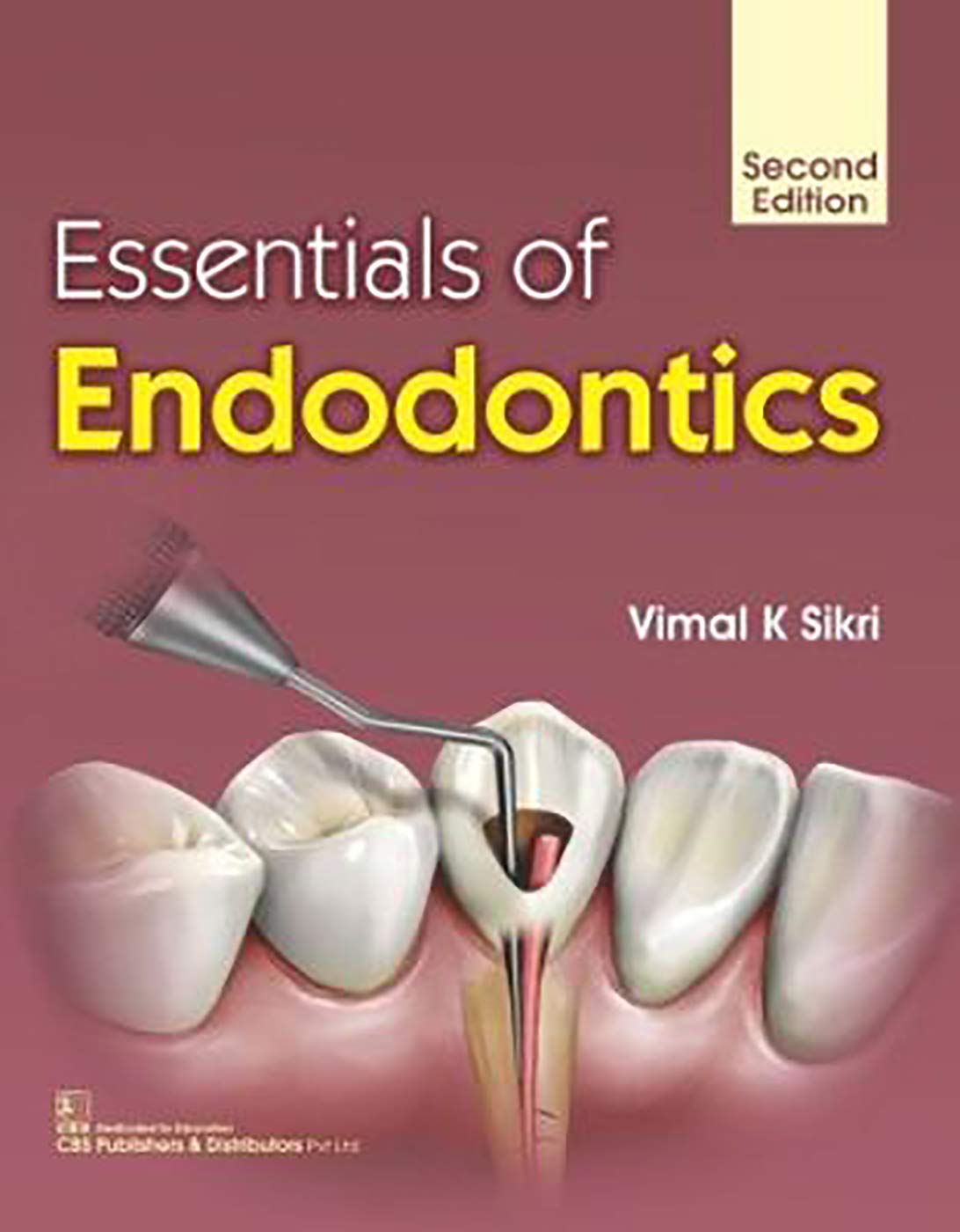 Essentials Of Endodontics 2Ed (Pb 2019)