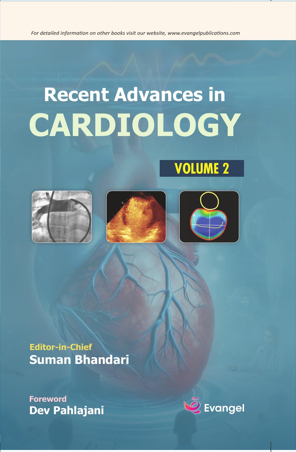 Recent Advances in Cardiology Vol-2