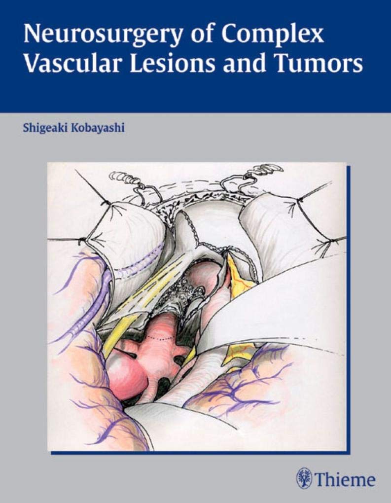 Neurosurgery of Complex Vascular Lesions and Tumors - Retail Maharaj