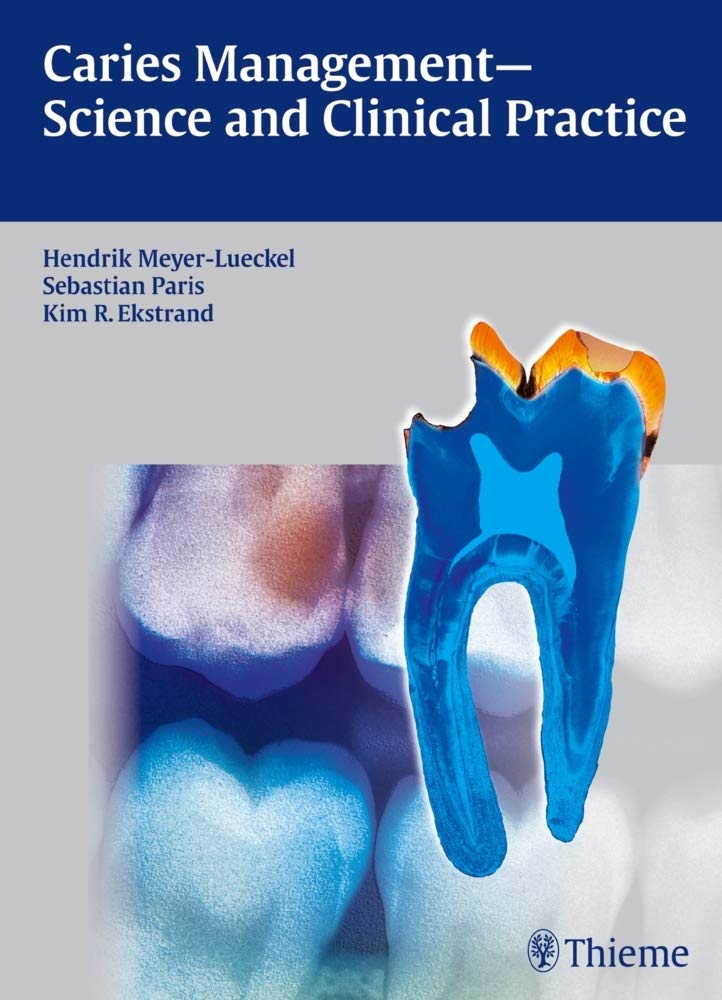 Caries Management - Science and Clinical Practice - Retail Maharaj