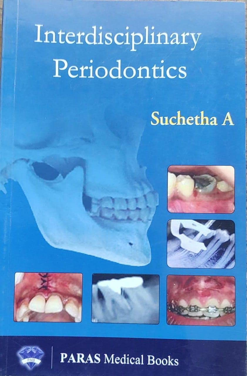 INTERDISCIPLINARY PERIODONTICS