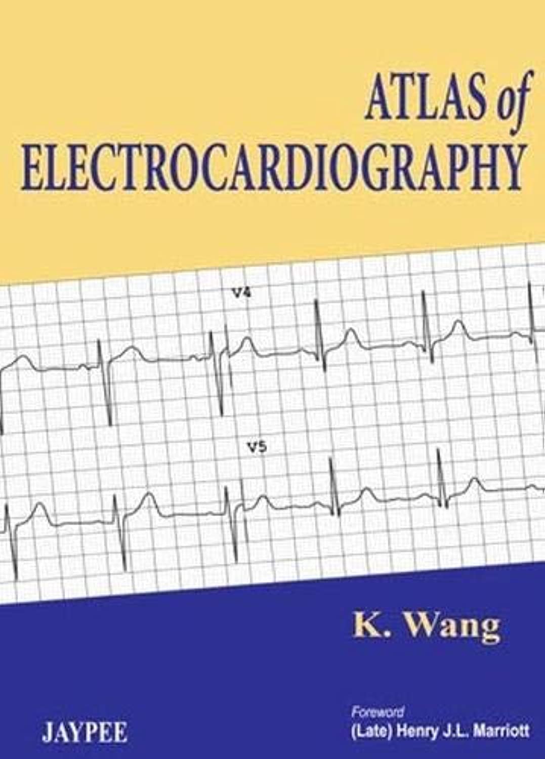 Atlas of Electrocardiography