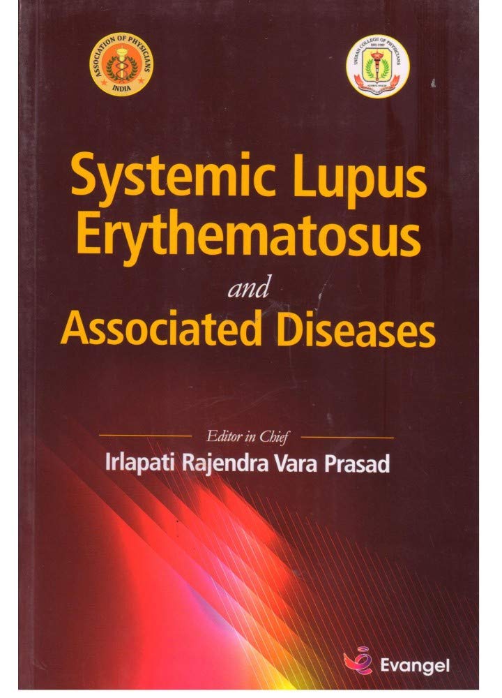 Systemic Lupus Erythematosus and Associated Disease