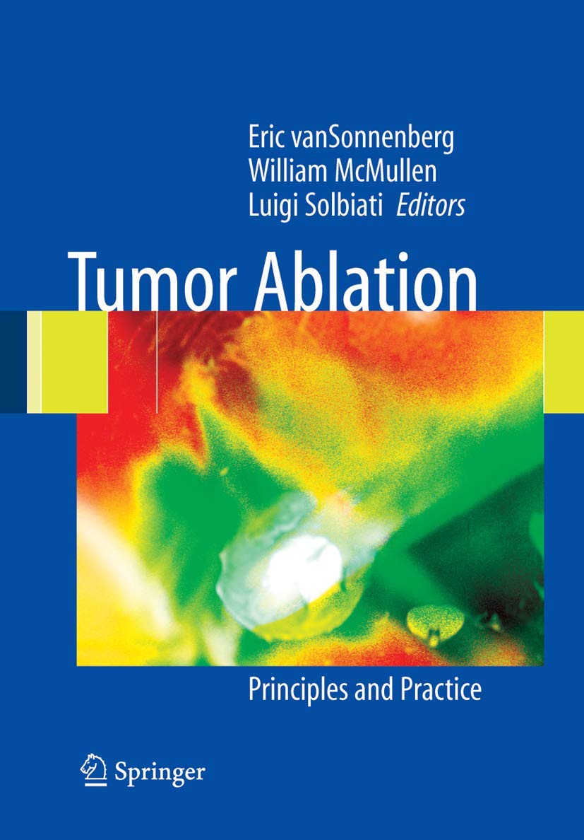 Tumor Ablation: Principles and Practice - Retail Maharaj