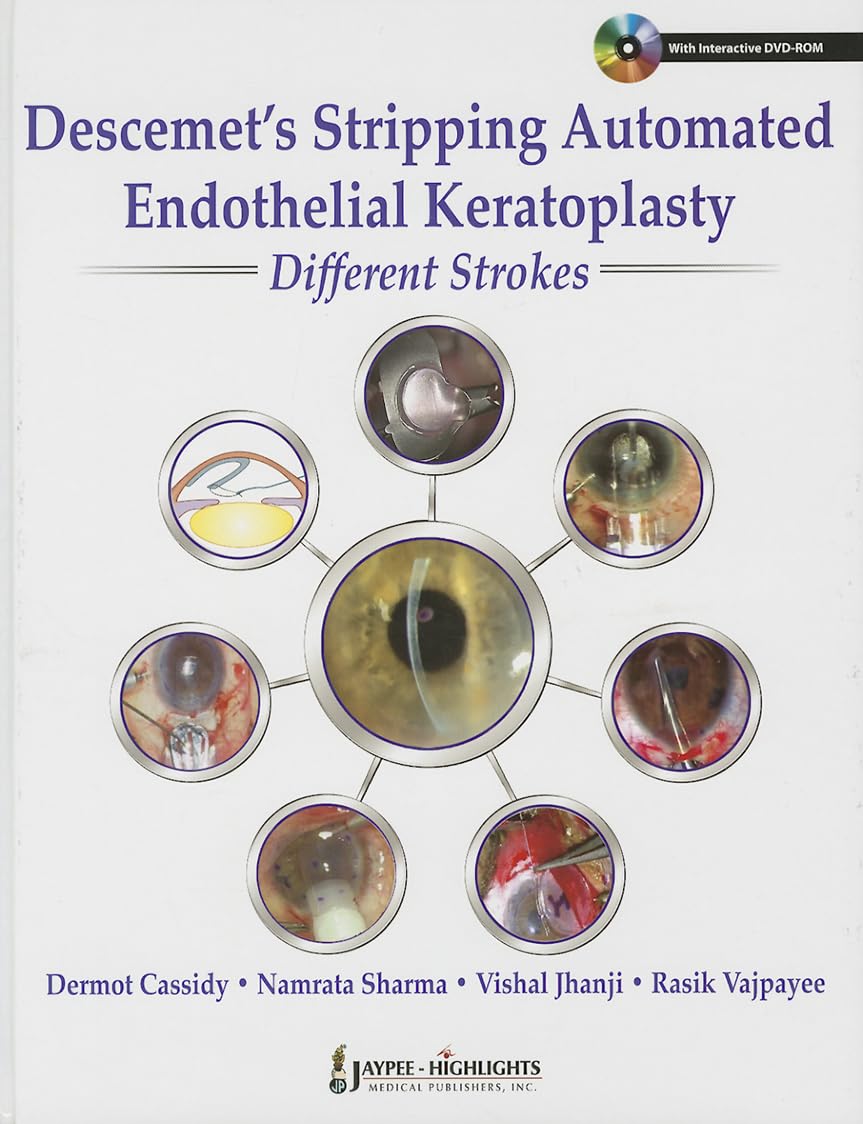 Descemet'S Stripping Automated Endothelial Keratoplasty:Different Strokes