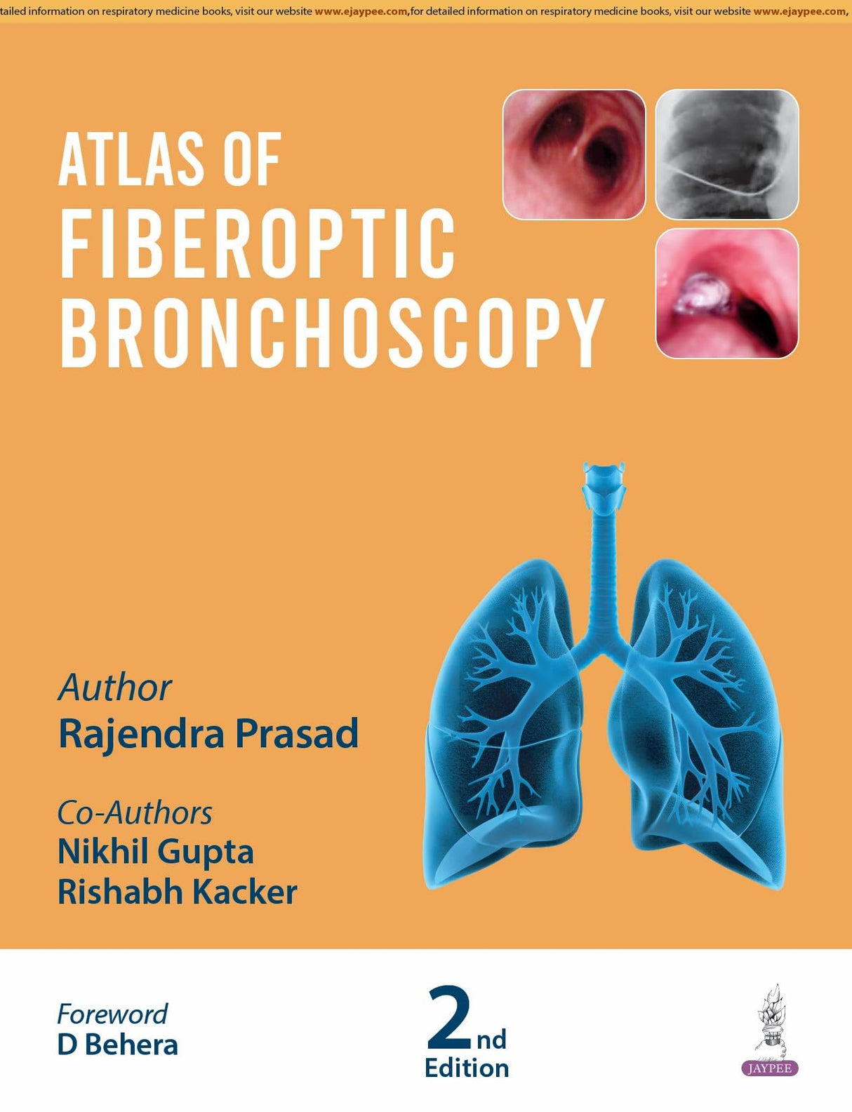 ATLAS OF FIBEROPTIC BRONCHOSCOPY