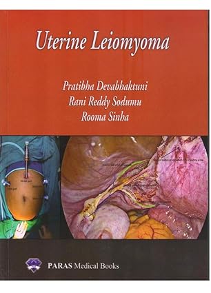 Uterine Leiomyoma (hardbound)